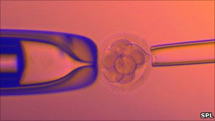 _53863128_m8020193-ivf_embryo_testing-spl.jpg