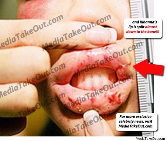 0224_rihanna_lips_mediaoutake_credit.jpg